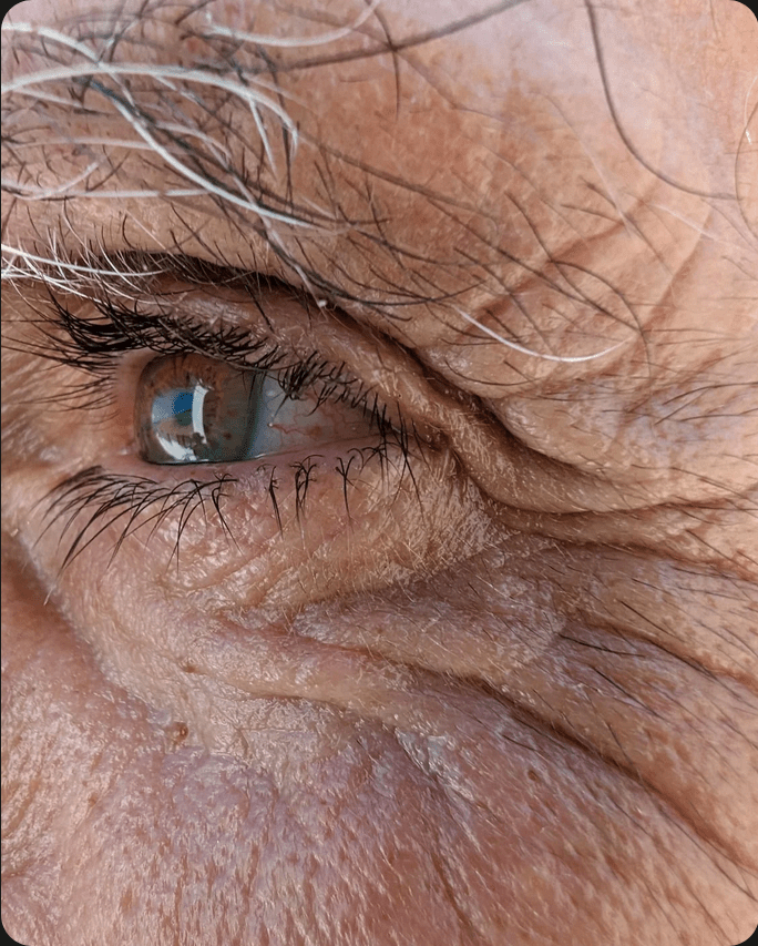 A beautiful close-up of a wrinkly eye