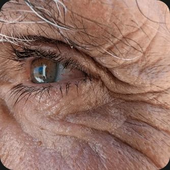 A beautiful close-up of a wrinkly eye